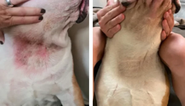 Atoopiline-dermatiit